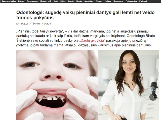 Lrytas.lt straipsnis „Odontologė: sugedę vaikų pieniniai dantys gali lemti net veido formos pokyčius"