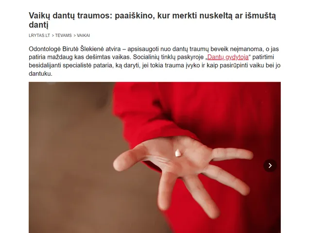 Lrytas.lt straipsnis „Vaikų dantų traumos: paaiškino, kur merkti nuskeltą ar išmuštą dantį"