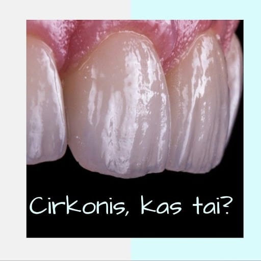 Gydytojas siulo cirkoni Kas tai yra ir kokie jo pranasumai Kas yra cirkonis