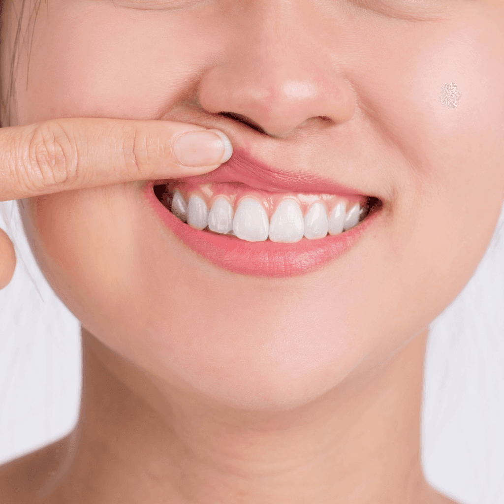 periodontologija periodontologas
