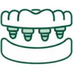 visi dantys ant 4 implantu